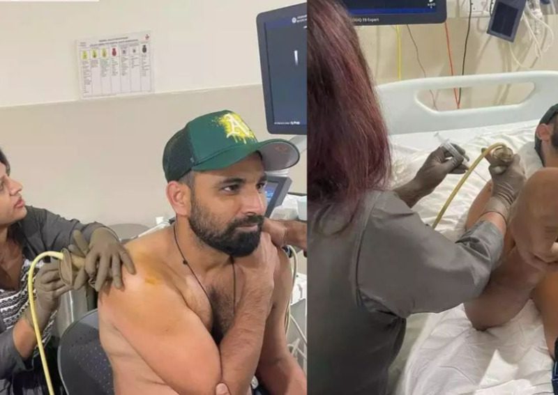 मोहम्मद शमी की हेल्थ पर आया अपडेट खुद वीडियो शेयर कर बताया कितनी गंभीर है उनकी चोट, कब होगी टीम में वापसी